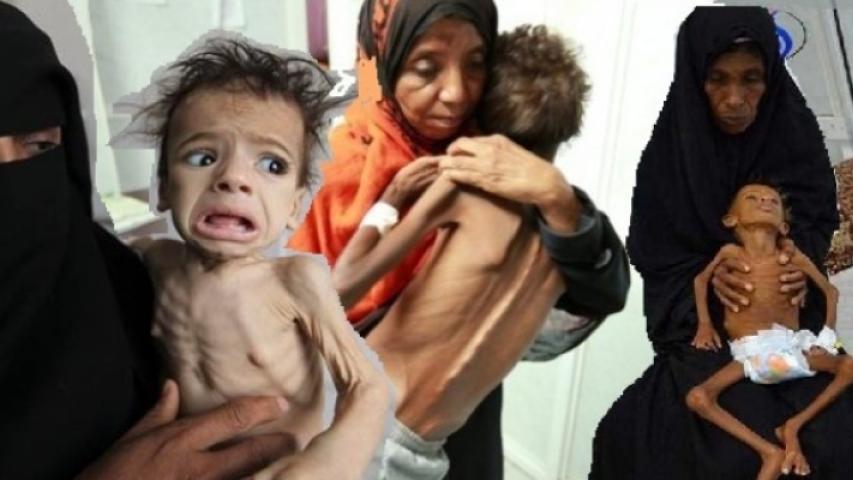 العربية تطلق حملة دولية تحت شعار "أوقفوا تجويع اليمن"